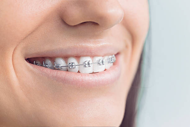 Best Invisalign and Clear Aligners  in Hermosa Beach, CA